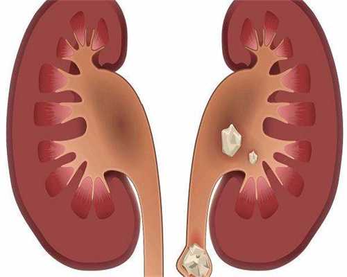 移植21天有鲜红色出血原因分析，除了移植失败还有这些可能