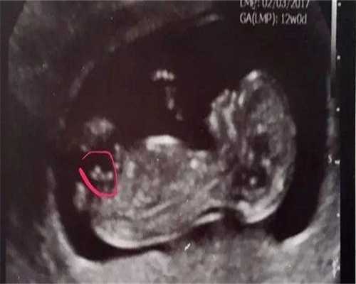 <strong>试管婴儿移植要求激素水平</strong>