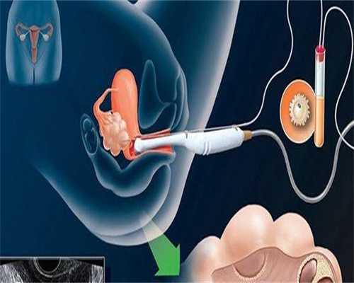 包成功代怀网-避孕药的对经期的影响