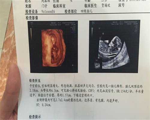 打肝素hcg翻倍快吗