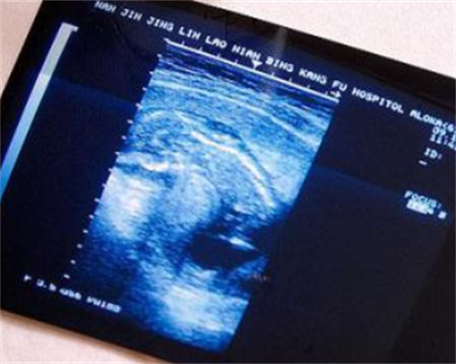 月经推迟3天，姨妈没来，也没测到