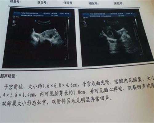 代孕产子服务-高龄胚胎移植着床成功后会流水状分泌物吗