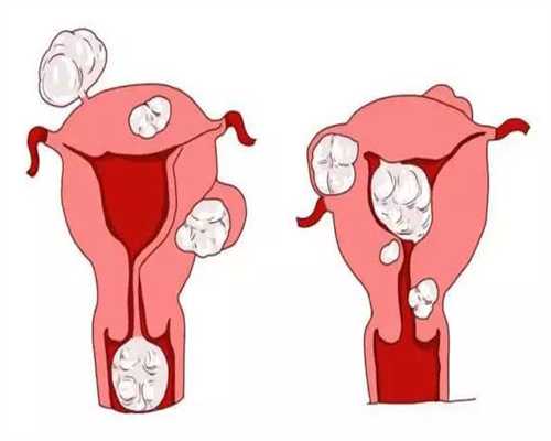 试管移植后可以吃芋头吗移植能吃芋头吗