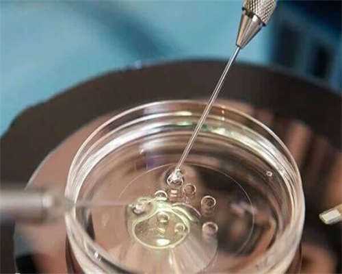 宫颈息肉怎么治疗