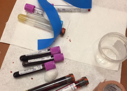 助孕捐卵-试管移植后腹水的轻重有差异！胚胎移植后出现腹水该怎么办